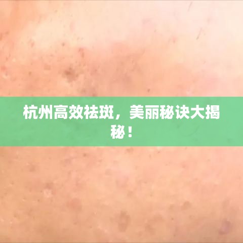 杭州高效祛斑，美麗秘訣大揭秘！