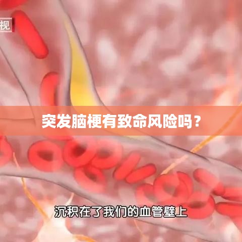 突發(fā)腦梗有致命風險嗎？