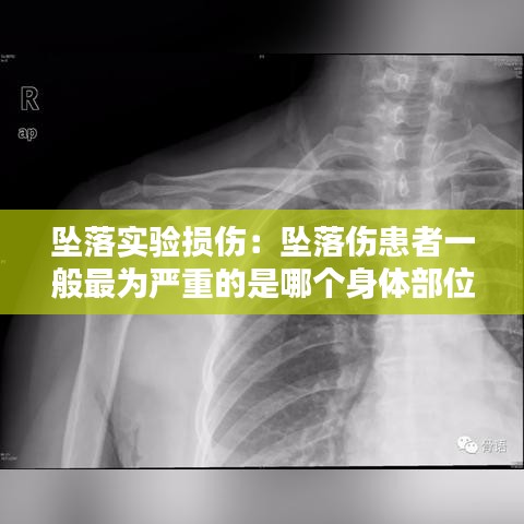 墜落實驗損傷：墜落傷患者一般最為嚴重的是哪個身體部位 