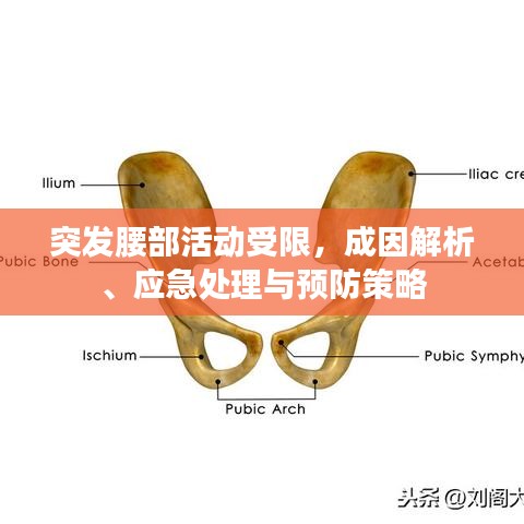 突發(fā)腰部活動受限，成因解析、應(yīng)急處理與預(yù)防策略