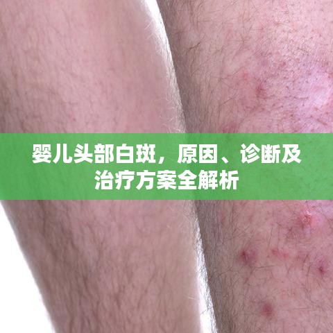 嬰兒頭部白斑，原因、診斷及治療方案全解析