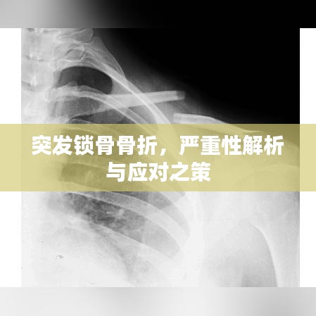 突發(fā)鎖骨骨折，嚴重性解析與應(yīng)對之策